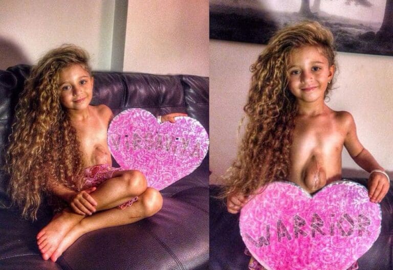 Virsaviya, la petite fille au coeur à l’extérieur de sa poitrine