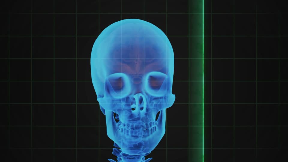 Des scientifiques utilisent des cellules souches pour faire croitre des os du crâne et du visage