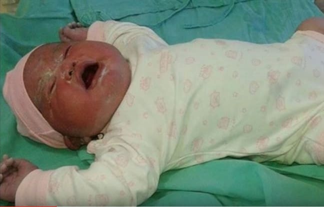 En Argentine, une femme donne naissance à un bébé de six kilos
