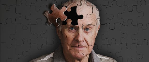 Maroc : Le nombre de malades d’Alzheimer atteindrait 150.000 (presse)