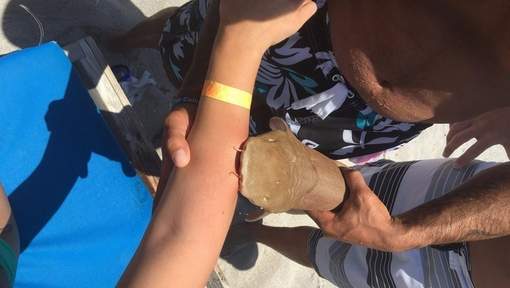 États-Unis: Une femme transportée aux urgences avec un requin au bras