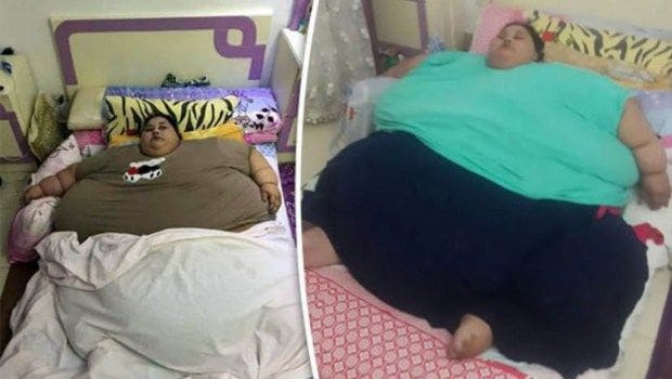 Eman Ahmed Abd El Aty: La plus grosse femme du monde, opérée avec succès et a même perdu 100 kg