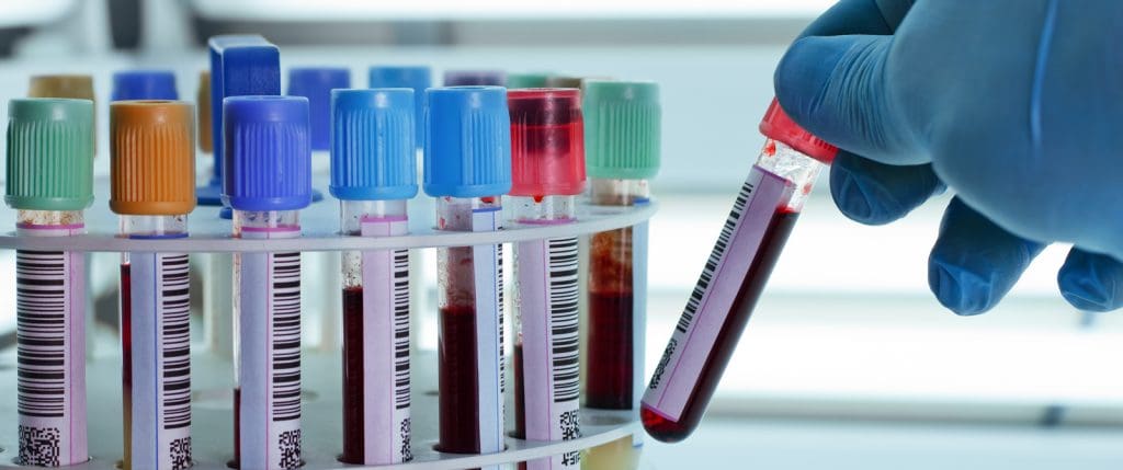 3 laboratoires ne répondant pas aux normes sanitaires ferment les portes