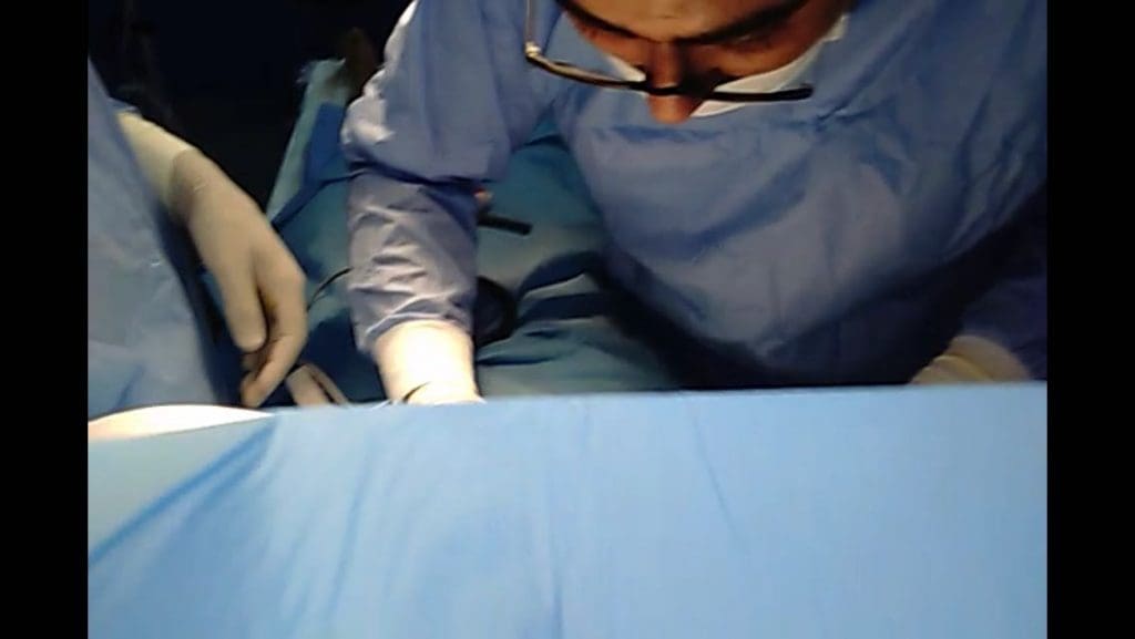 Exclusif: Réalisation d’une opération de thyroïdectomie pour la première fois au CHP d’Azilal