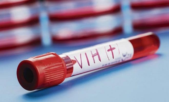 Des milliers de Marocains atteint du virus du SIDA en 2017