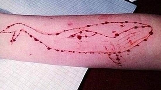 Une lycéenne se fait tatouer une baleine sur son avant bras