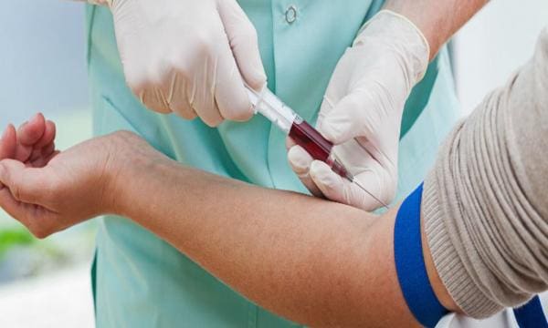 La tuberculose, un fléau qui continue à sévir au Maroc