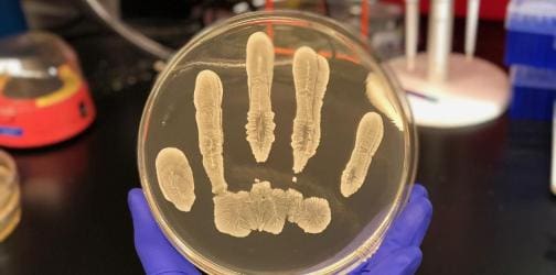 Staphylocoque blanc : une bactérie contre le cancer de la peau