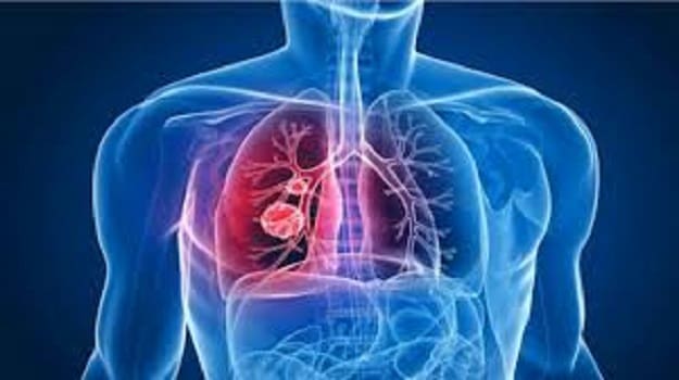 HCP : la tuberculose est toujours l’un des problèmes de santé publique au Maroc
