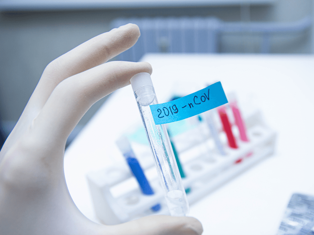 Covid-19 : le Sénégal compte produire de nouveaux kits rapides de dépistage