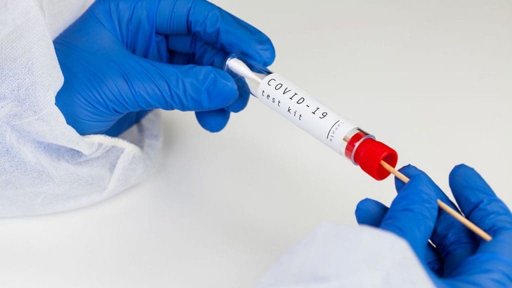 Tests PCR : l’insoutenable lenteur de la réglementation des prix