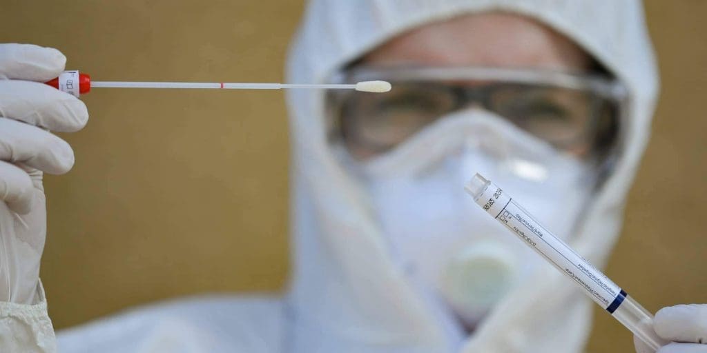 Les prix des tests PCR seront fixés à 400 Dhs
