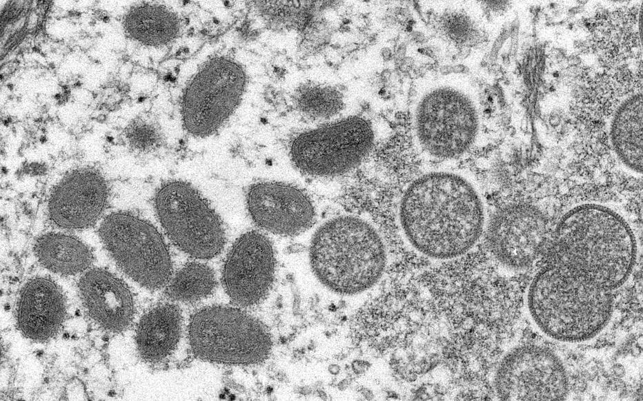 Variole du singe: risque «très faible» d’une vaste contagion, selon une agence européenne