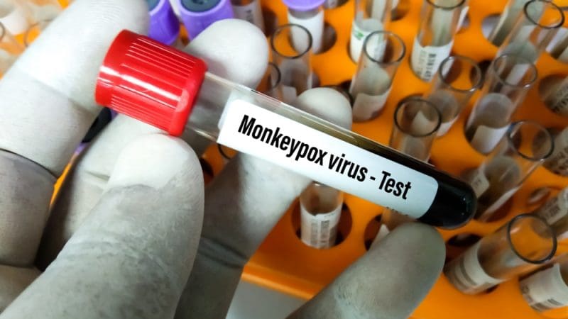 Variole du singe : l’OMS soupçonne une «transmission non détectée»
